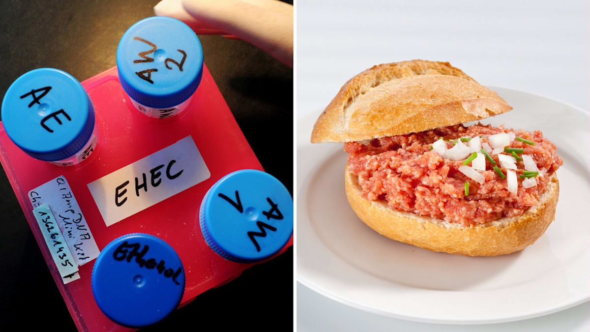 Ehec Infektion - Article 2